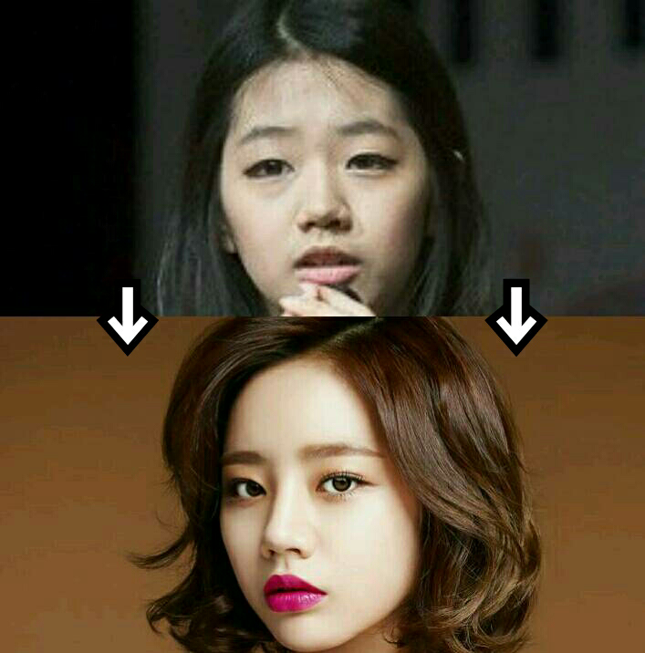 Girl's Dayヘリ整形前後写真楽しく体験する韓国♪チューのブログ