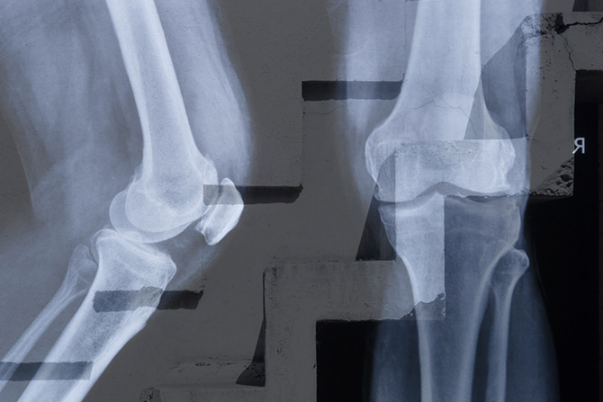 変形性ひざ関節症再生医療 認定医 Dr.植田 康夫