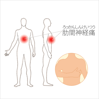 胸の痛み 胸痛よく見られる大人の病気 - みやけ内科・循環器科 家庭の医学
