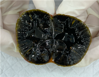 第99回薬剤師国家試験 問292〜293 - yakugaku lab