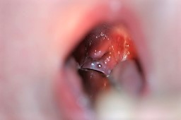 人間の皮膚の皮膚炎。皮膚科疾患症状はかゆみ、痛み、発赤、発疹です。アレルギー反応。医療診断と治療。ベクターイラストのイラスト素材・ベクター Image188945986