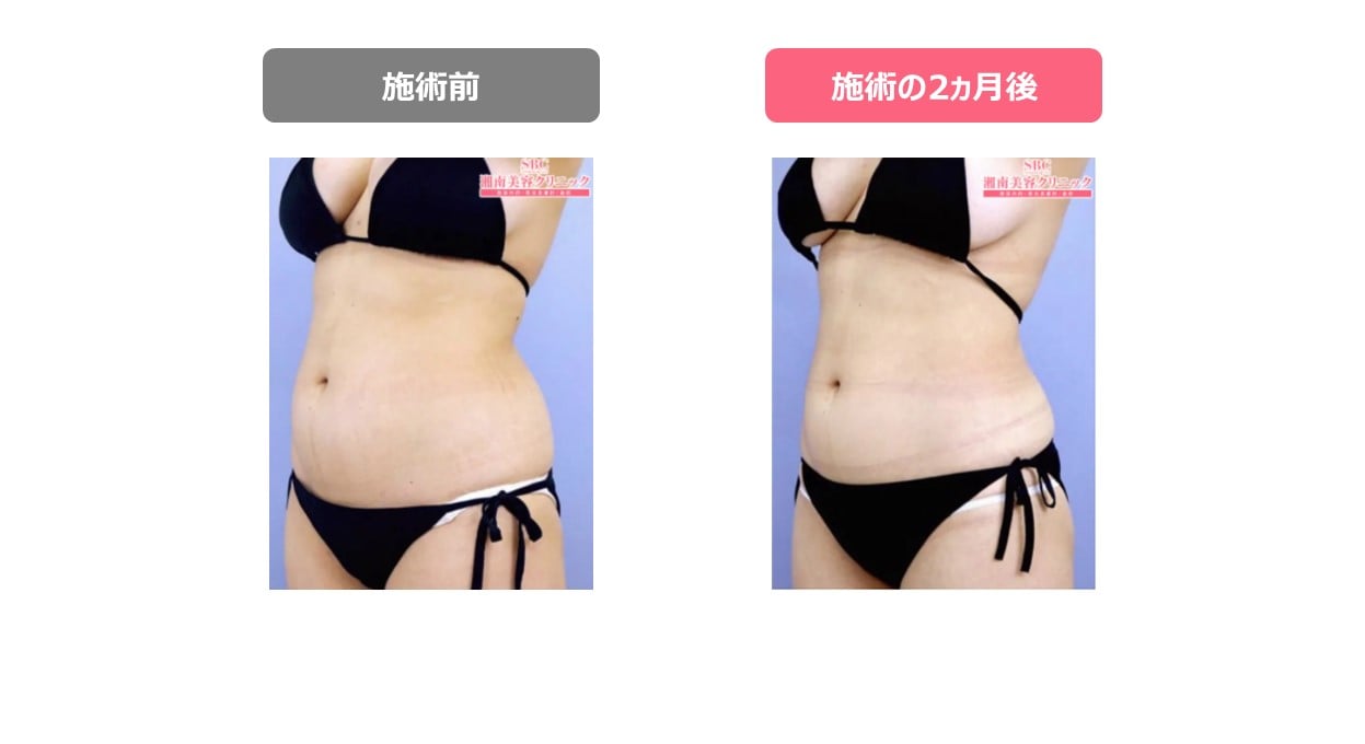 腰回りの脂肪を落とす筋トレメニュー10選！ダイエットに効果的なコツ&食事法も解説 – uFit