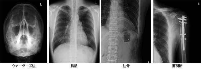 診察時の服装とレントゲン写真撮影おかやま股関節Cafe