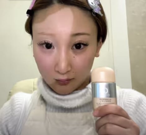 動画 メラニンを作る細胞が皮膚から突如なくなり白斑が体中に生じた女性 尋常性白斑ねこでもわかる生物学