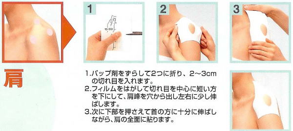 治療例4 半月板が傷んでいると言われた膝の痛み - 治療室そら藤沢市湘南台の鍼灸院ハリ 鍼灸 逆子 肩こり 腰痛