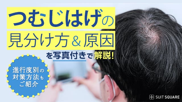 つむじがハゲてる？ - 高校生の男ですこれはハゲてるのでしょうか- Yahoo!知恵袋