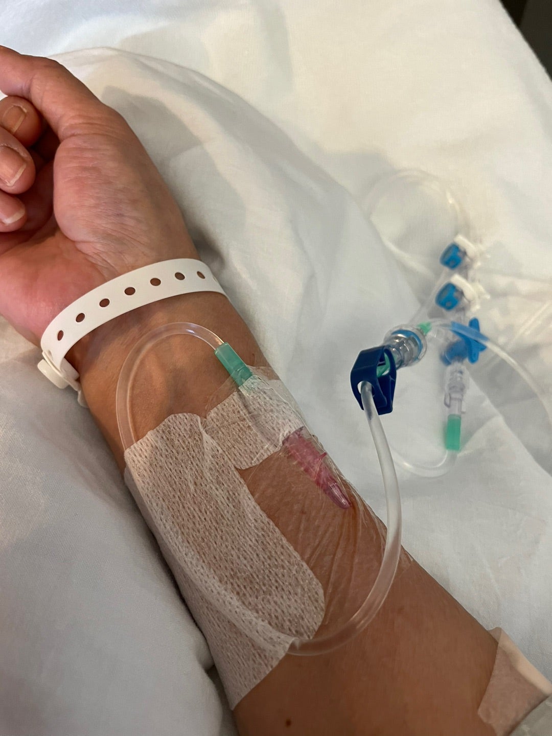 チエナム®点滴静注用0.5g 製剤写真MSD Connect