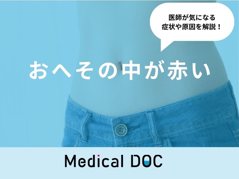 臍炎、尿膜管遺残症の治療について医療法人社団實理会 東京国際大堀病院
