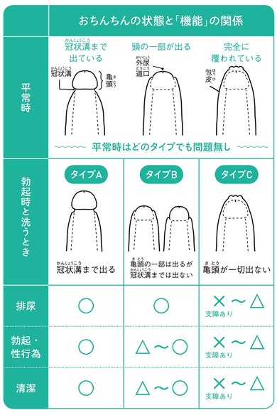 包茎手術法｜包茎治療・包茎手術専門クリニック-東京の銀座みゆき通り美容外科