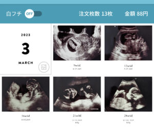 消えちゃう前に！エコー写真の保存方法📸 - - - - - - - - -ALBUSでは、利用を始めた月よりも前の写真をさかのぼって注文することができます。 お子さんが生まれてからALBUSをはじめたユーザーさんに話を聞くと、 エコー写真やマタニティフォトなどをプリントしている人も