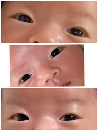 赤ちゃんの目が小さい・細い！大きさは変わる？腫れぼったい理由は？ - こそだてハック