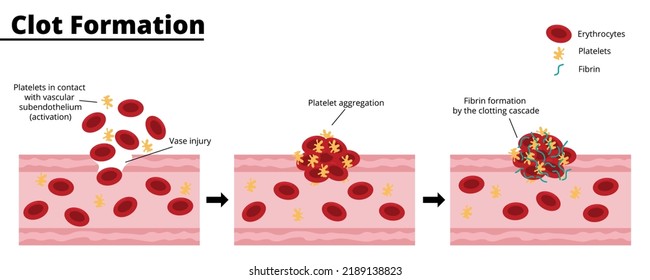 2,400点を超える血小板のイラスト素材、ロイヤリティフリーのベクター素材グラフィックスとクリップアート - iStock赤血球, 血液, 血管