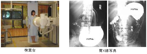 胃がん発見の為の胃カメラ検査の有用性