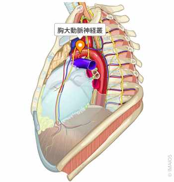 胸部大動脈手術