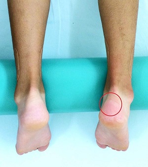 なぜつま先歩きに？発達障害かもしれない子どもの歩行を改善する方法 - へやすぽナビ