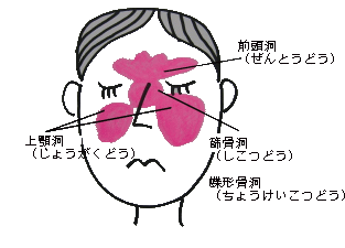 子供の鼻水が止まらない・なかなか治らない原因と対処法 えちごクリニック吹田市北千里