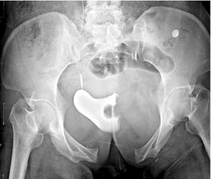 レントゲン、レントゲン写真、人体」の写真・イラスト素材アマナイメージズ