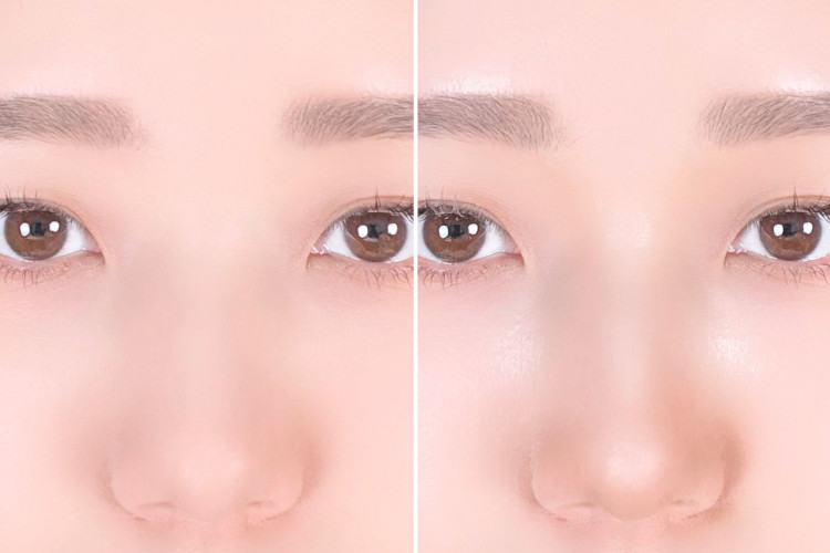 鼻の形ごと お悩みを解消するメイクテクをプロが教えます！美的.com