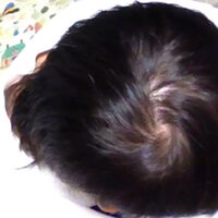 女子高生なのに薄毛>_< - こんばんは 現在、高校三年生 Q&A - @cosme アットコスメ