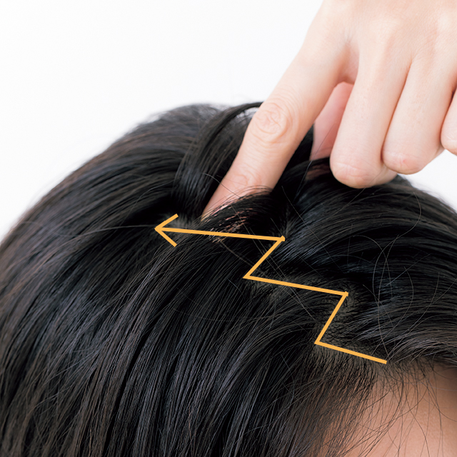 医師監修 女性の頭頂部の薄毛の原因と改善策 -公式 AGAスキンクリニックレディース