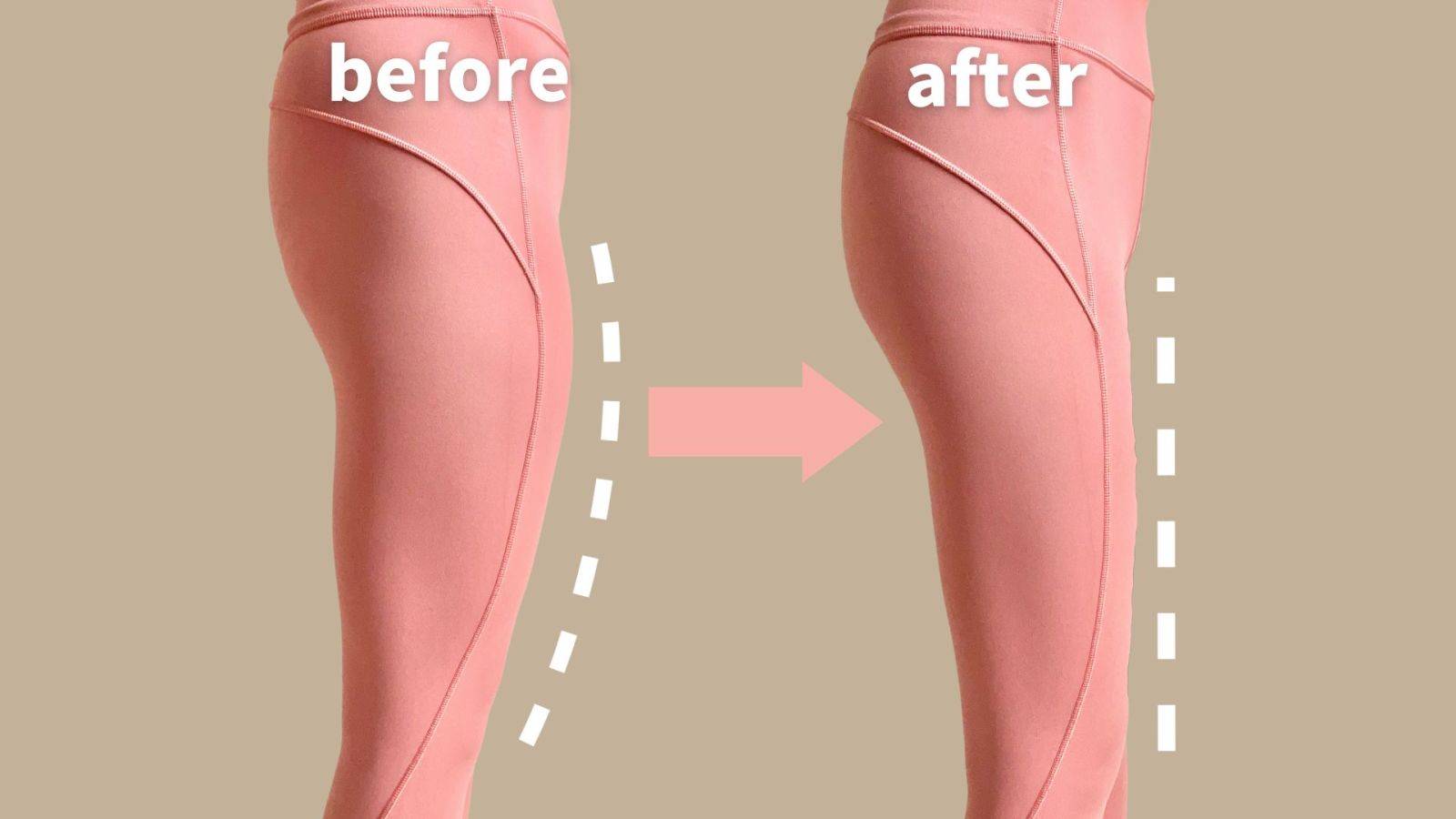 太ももの痛い原因を部位別に解説！医師が監修