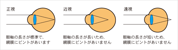 老眼のイラストかわいいフリー素材集 いらすとや