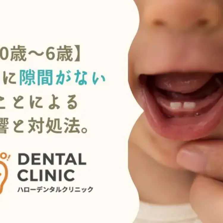 なぜ？「10ヶ月なのに歯が生えない」赤ちゃんの歯が生える前兆・病気の可能性についてもkosodate LIFE 子育てライフ