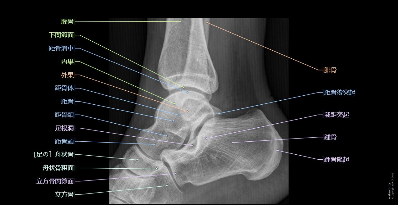 股関節の痛みの治療柏の葉整形外科リハビリテーションクリニック