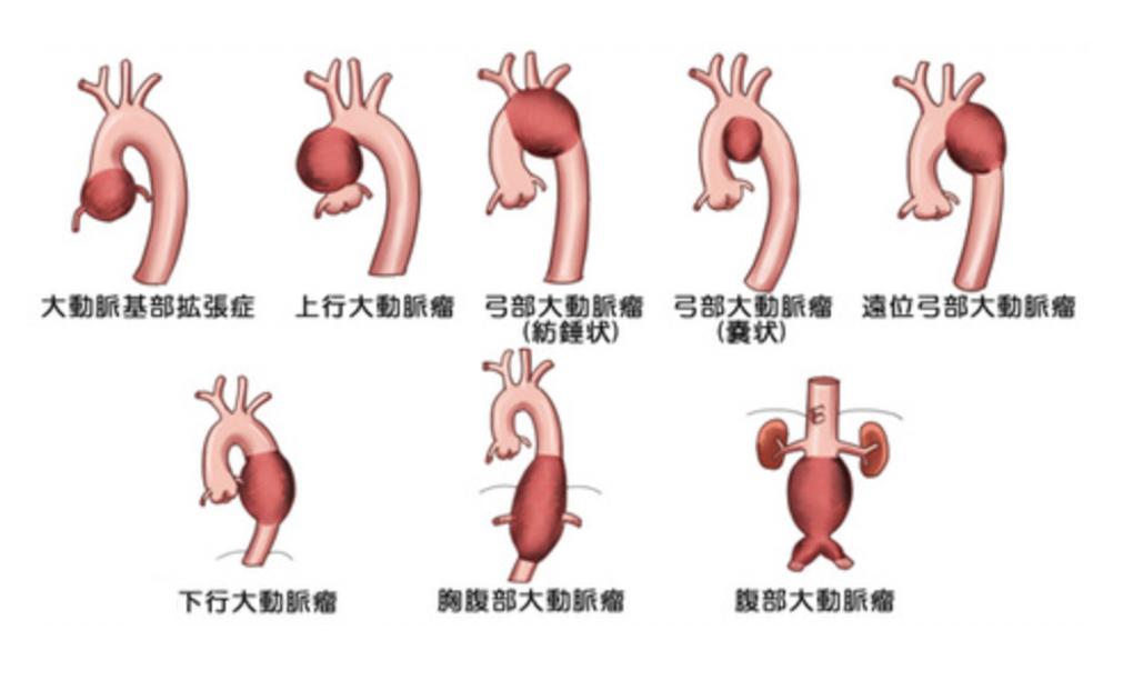 大動脈の全体像 側面 壁側枝を中心としてこちらは側面より見た図です。 肋間動脈に相当するものが腰動脈であることがよくわかります。 肋間動脈は 胸大動脈の後ろ側より左右でて、肋間部を後ろから前に走行します。 一方、鎖骨下動脈の枝、内胸動脈の前肋間枝は肋間