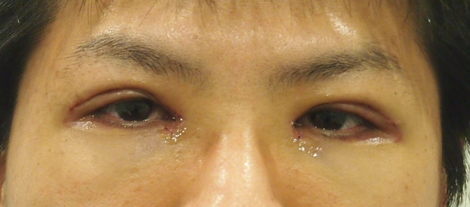 人相学 凶相に見られる特徴とは？ 男性・女性別に解説 1ページ目 「マイナビウーマン」