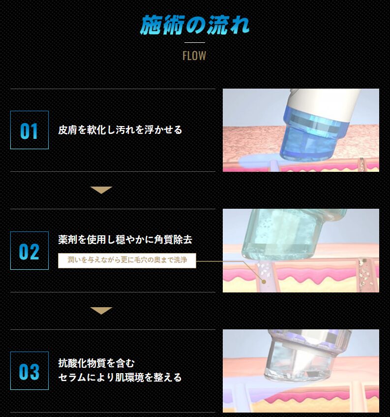 ゴリラクリニックのハイドラフェイシャルを初体験！口コミ通りの結果に⁉ - やってみたブログ