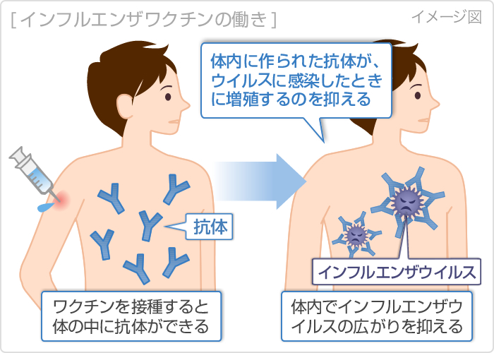 インフルエンザ予防接種で腫れる理由と対処法阪野クリニック