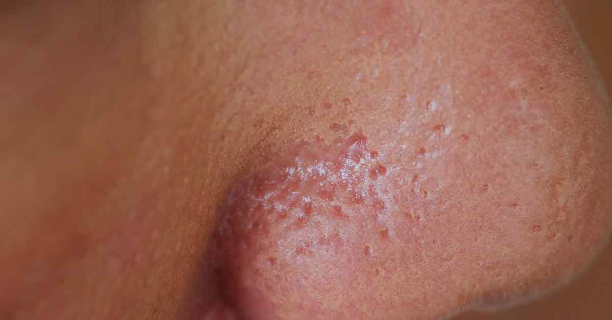 販売終了 エナージュ超音波ピーリングKBE-2730コイズミオンラインショップ