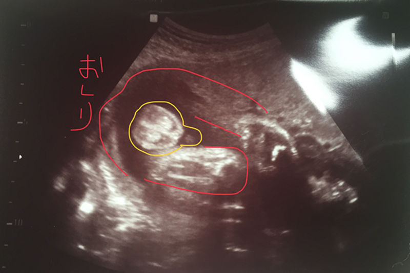 妊娠中期の胎児の成長と能力看護roo! カンゴルー