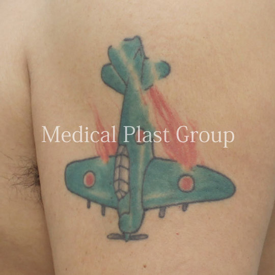 入れ墨 皮剥ぎ 標本TikTok