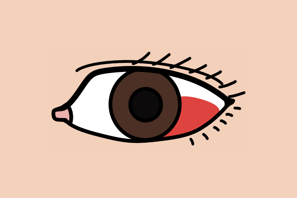 目が赤い 白目が赤い 原因と治し方藤沢市辻堂の辻堂神台眼科茅ヶ崎・藤沢