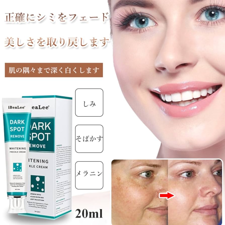 ♡ 次世代機美白クリームの シスペラクリーム使用の症例です🤍🤍 before・afterの色調が違ってすみません´•_•。 💧 🥚お悩み肝斑、くすみ 🥚シスペラクリーム2本使用 🥚費用 1本 35,200円 シスペラはシステアミン配合の化粧品です。 システアミンはヒト細胞中で合成