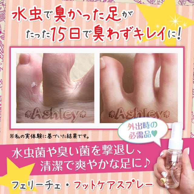 Amazon.co.jp: 木酢液200ｍｌ水虫 足の臭い 足の消臭 かゆい水虫 : ドラッグストア