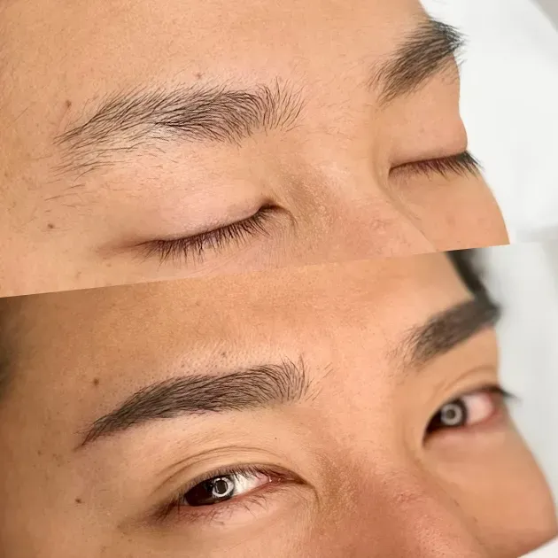 おすすめ4選 福岡のメンズアートメイククリニック眉毛アートメイクが安く受けられるところは？眉アート・アートメイクのArt+