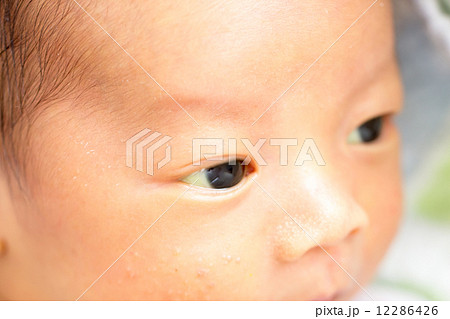 赤ちゃんの肌や白目が黄色いのはなぜ？赤ちゃんの黄疸の原因や治療について 医師監修 ガーデンヒルズウィメンズクリニック福岡市中央区の産婦人科