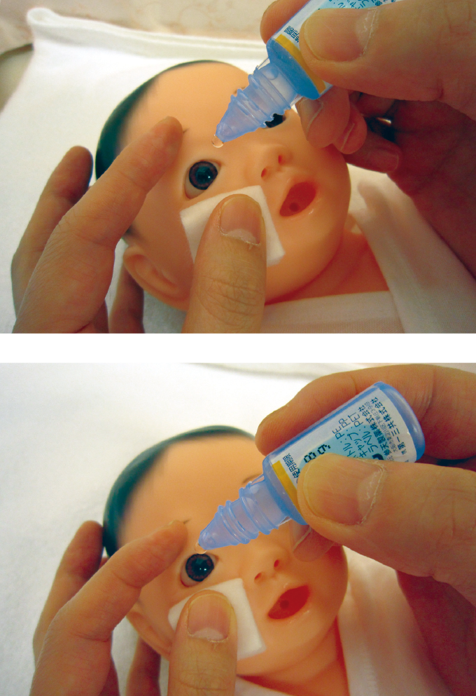 新生児の臍帯 おへそ 処置は、乾燥させる？消毒する？： ランダム化比較試験