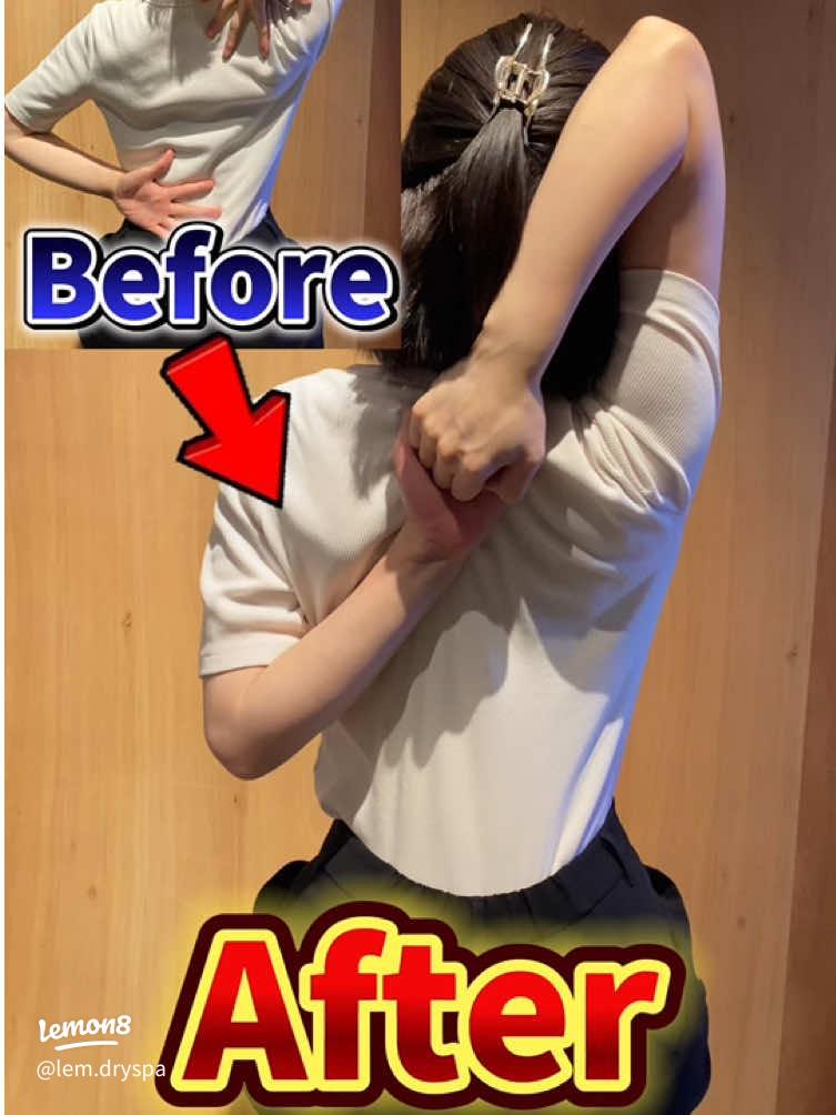 右の肩甲骨・肩の動きが硬くなる意外な原因２つの対策バレエダンサーさんの治療院