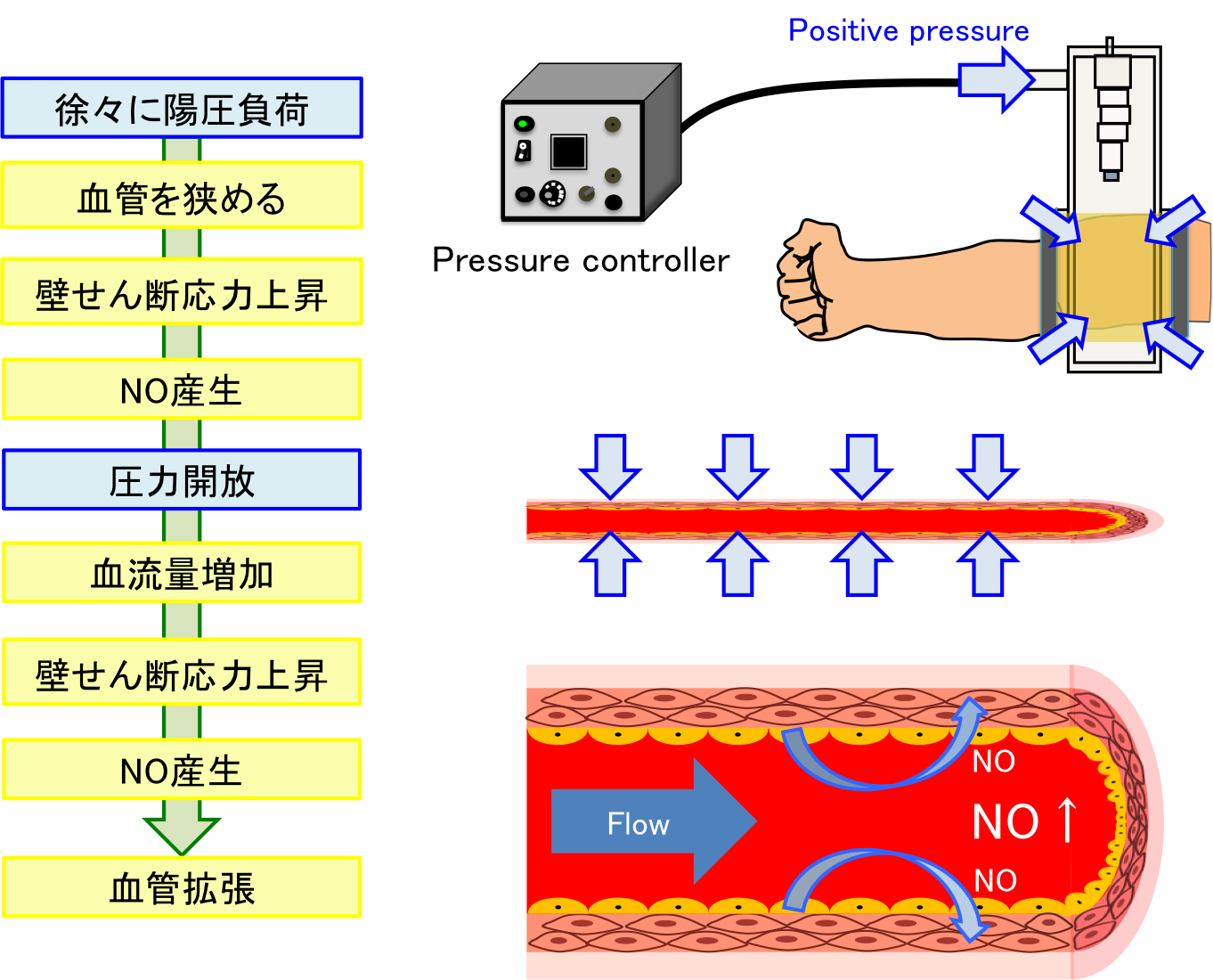 Abierto Reading Support Solutionにおける脳動脈瘤候補検出アプリケーション EIRLaneurysm の使用経験国際医療福祉大学成田病院様EIS ITソリューション 導入事例epicusCLUBキヤノンメディカルシステムズ株式会社