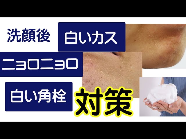 美肌 白いポツポツの『正体』『原因』『なくす方法』解説！50歳セラピストの美肌のためのリアルケア