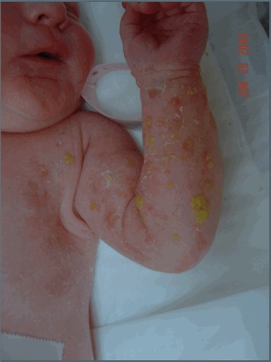 医療設備・症例 - いしかわ皮膚科富士宮市北町 皮膚科専門の診療所