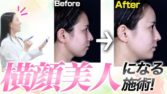 石原さとみ・橋本環奈・白石麻衣・中条あやみ 美女の横顔特集＜Part1＞ - モデルプレス