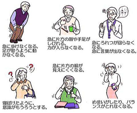 手がしびれる原因は？考えられる病気について。何科を受診する？病気スコープ