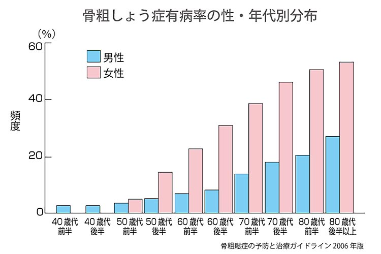 骨粗鬆症について 健康・介護のまめ知識医療法人高生会
