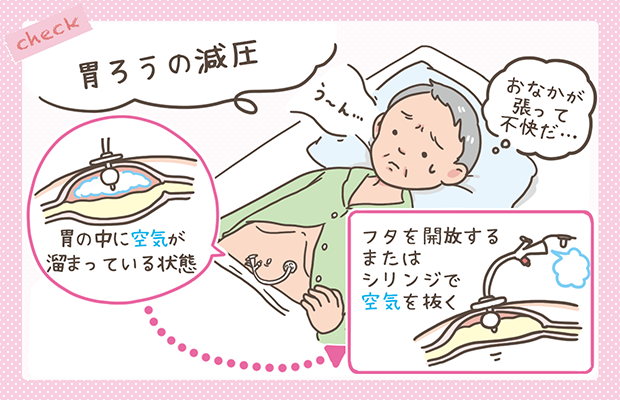 お腹のガス抜きに即効性がある対処法は？お腹の張り・圧迫感に効く対処法や予防法を紹介！おなかの不調、整腸、便秘、軟便には酪酸菌配合のビオスリーアリナミン製薬