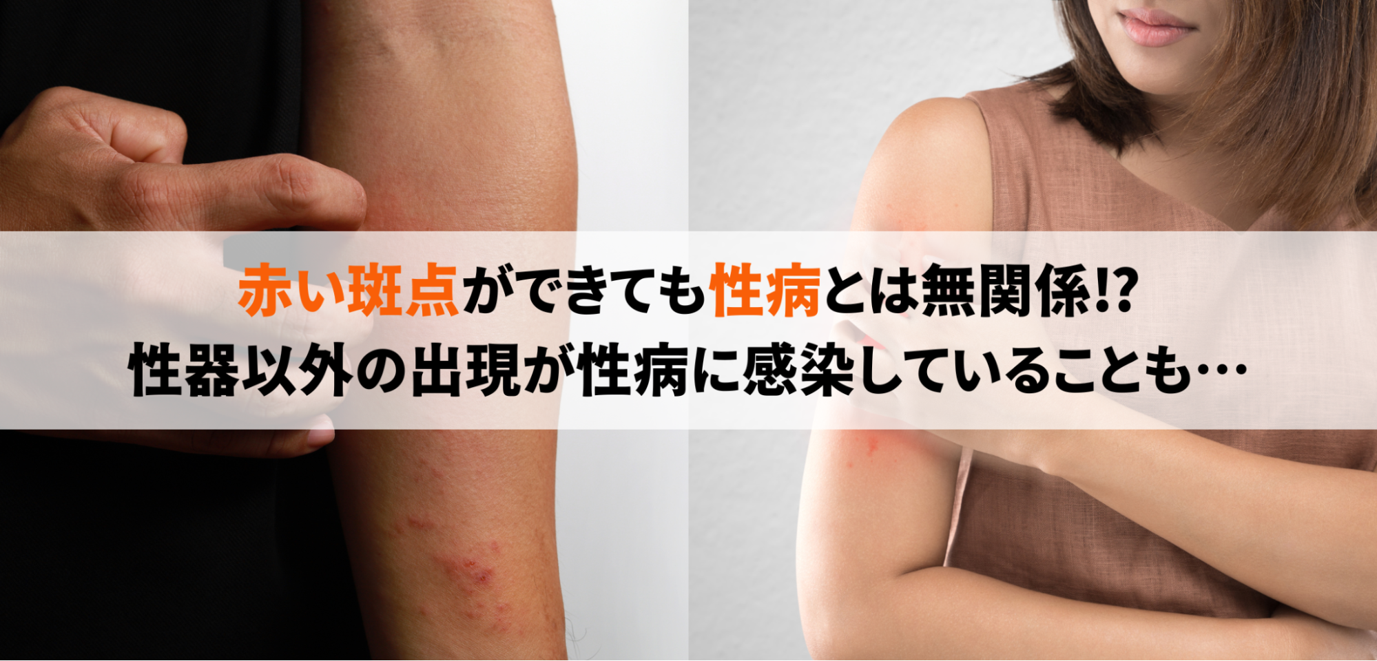 口囲皮膚炎ひまわりクリニック